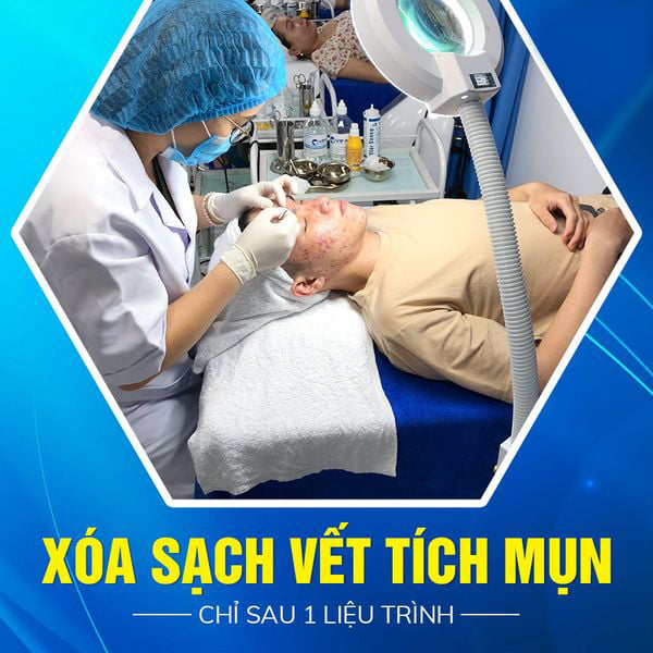 Cách viết bài về mụn - LOUIS Spa Đông Hà 